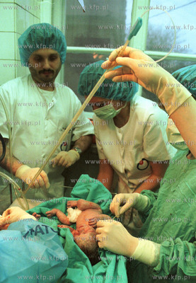 Gdanskie czworaczki tuz po porodzie. Druga z kolei...