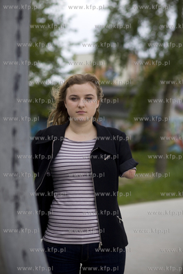 Kasia Komuda straciła w wypadku ( porażenie przez...