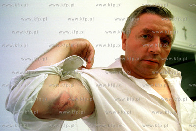 Andrzej Lepper rana /podobno/ po gumowej kuli odniesiona...