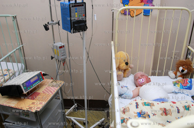 Zyciu poltorarocznego Kacpra (NZ) , ktory poparzony...