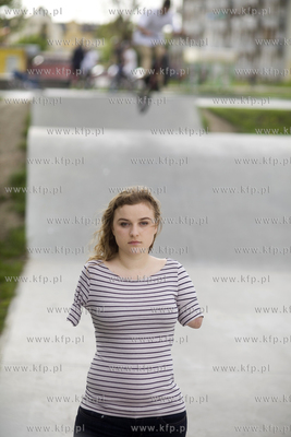 Kasia Komuda straciła w wypadku ( porażenie przez...