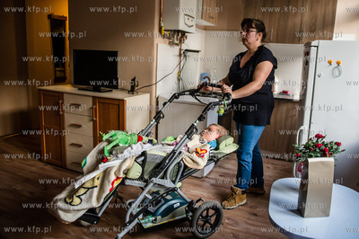 Gdansk. 8-letni Pawela, cierpiacy na rdzeniowy zanik...