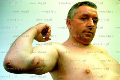 Andrzej Lepper rana /podobno/ po gumowej kuli odniesiona...