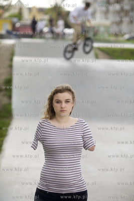 Kasia Komuda straciła w wypadku ( porażenie przez...