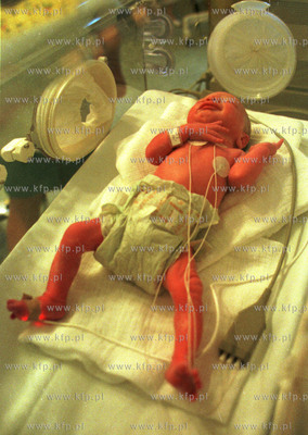 Gdanskie czworaczki, trzeci z kolei Michal pol godziny...