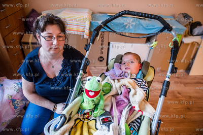 Gdansk. 8-letni Pawela, cierpiacy na rdzeniowy zanik...