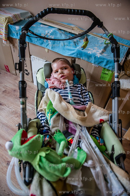 Gdansk. 8-letni Pawela, cierpiacy na rdzeniowy zanik...