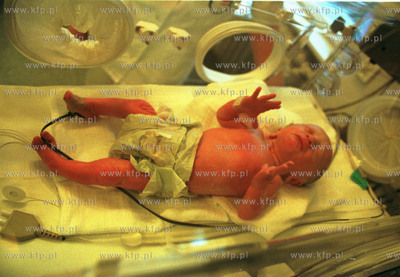 Gdanski czworaczki, pierwszy narodzony Patryk pol godziny...