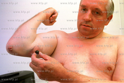 Andrzej Lepper rana /podobno/ po gumowej kuli odniesiona...