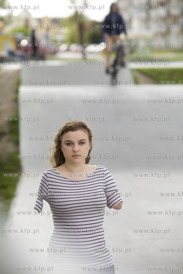 Kasia Komuda straciła w wypadku ( porażenie przez...