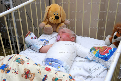 Zyciu poltorarocznego Kacpra (NZ) , ktory poparzony...