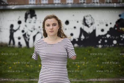Kasia Komuda straciła w wypadku ( porażenie przez...