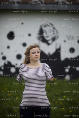 Kasia Komuda straciła w wypadku ( porażenie przez...