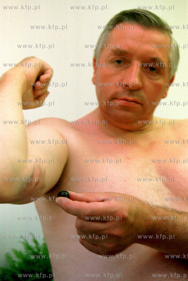 Andrzej Lepper rana /podobno/ po gumowej kuli odniesiona...