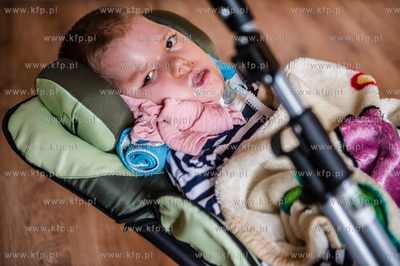 Gdansk. 8-letni Pawela, cierpiacy na rdzeniowy zanik...