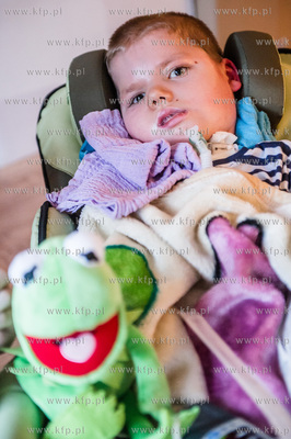 Gdansk. 8-letni Pawela, cierpiacy na rdzeniowy zanik...