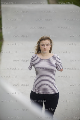 Kasia Komuda straciła w wypadku ( porażenie przez...