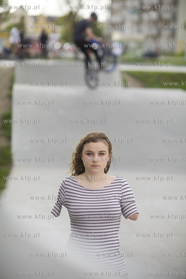 Kasia Komuda straciła w wypadku ( porażenie przez...
