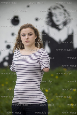 Kasia Komuda straciła w wypadku ( porażenie przez...