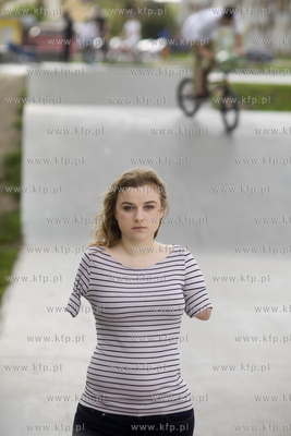 Kasia Komuda straciła w wypadku ( porażenie przez...