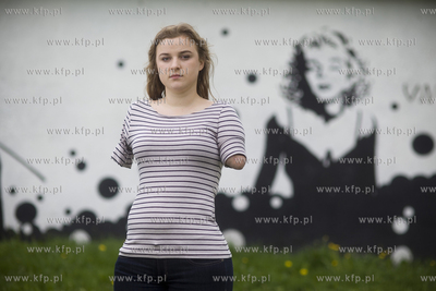 Kasia Komuda straciła w wypadku ( porażenie przez...