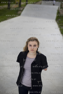 Kasia Komuda straciła w wypadku ( porażenie przez...