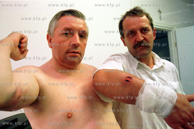 Andrzej Lepper i Adam Oldakowski rana /podobno/ po...